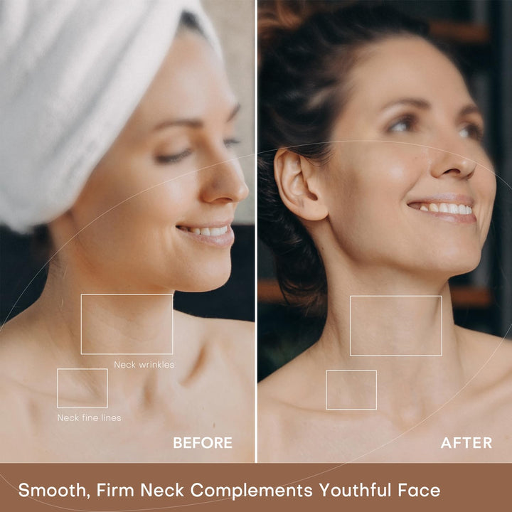 Red Light Therapy for Neck Wrinkles Treatment, Wireless Led Neck Mask for Smoothing Neck Lines and Wrinkles, Portable 850 Nm Near-Infrared Light Therapy Neck Skin Care Device for anti Aging at Home