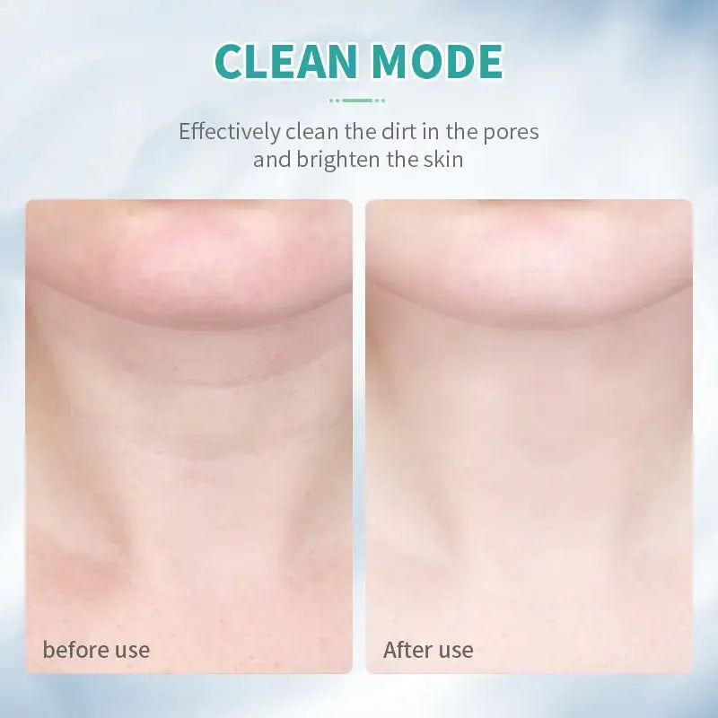 NovaGlow Facial Massager Red Light Therapy Skin Tighten Tool - NovaGlow™